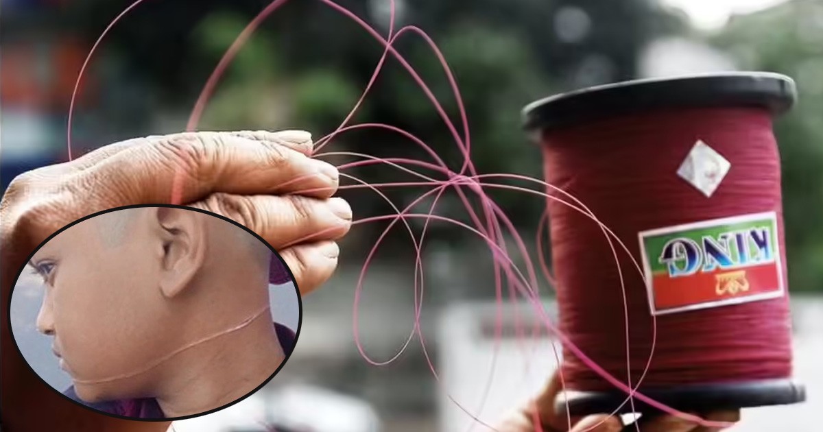 ગળુ કાપતી દોરી માટે હત્યાનો ગુનો લાગશેઃ જો યોગી આ  કરી શકે તો ભપેન્દ્રભાઇ તમે ના કરી શકો..?