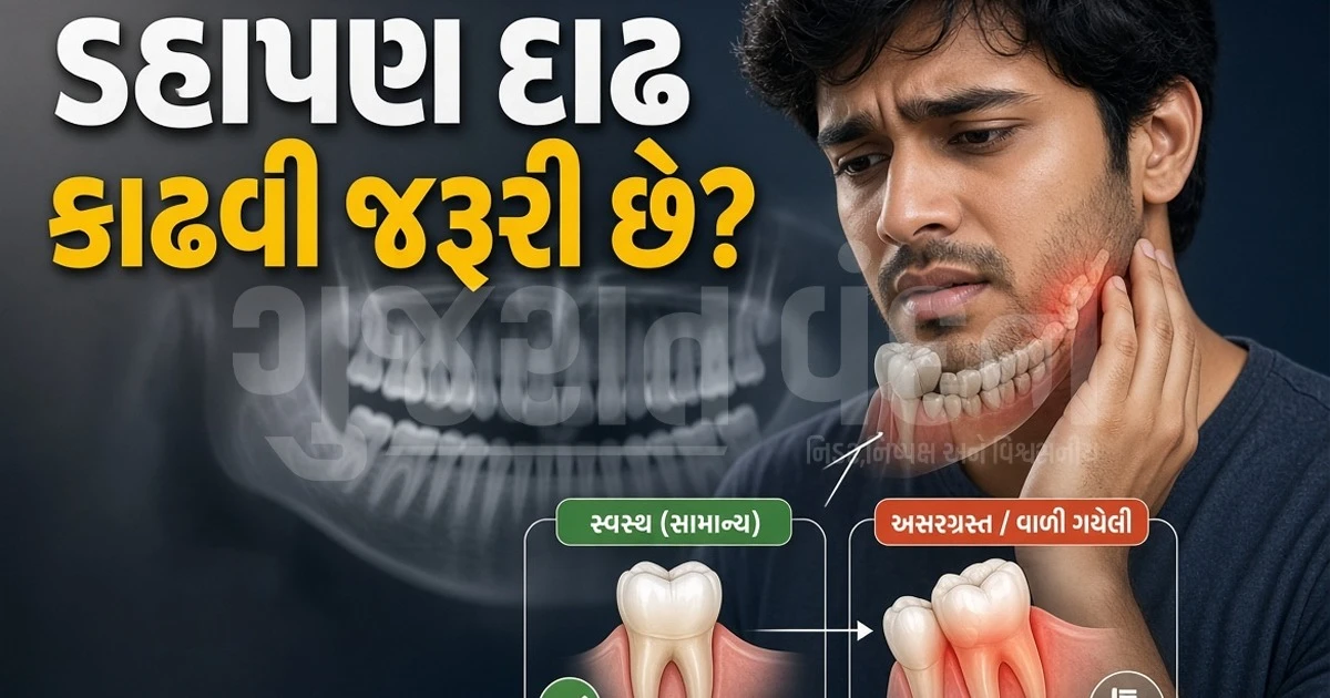 ડહાપણની દાઢ ખરેખર કામની છે કે નહીં? આ 5 સંકેત દેખાય તો કરાવો ડેન્ટલ ચેકઅપ