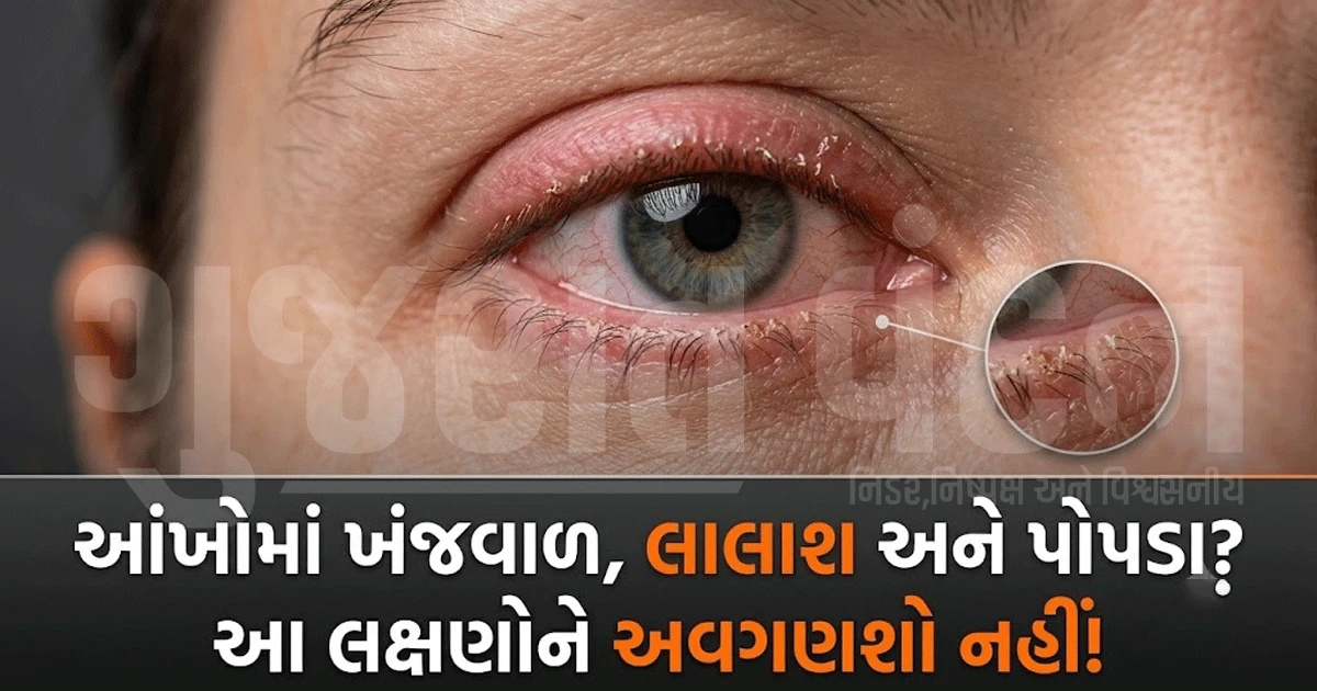શું તમારી આંખો પણ વારંવાર લાલ થાય છે, ખંજવાળ કે બળતરા થાય છે? ક્યાંક આ કોઈ બીમારીનો સંકેત તો નથી ને?